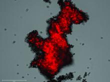 Image shows red, flourescently-labelled SCLC cells invading a lung organoid.